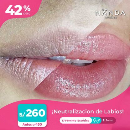 ¡Neutralización de Labios! 😍 - D'Femme Estética (SURCO)