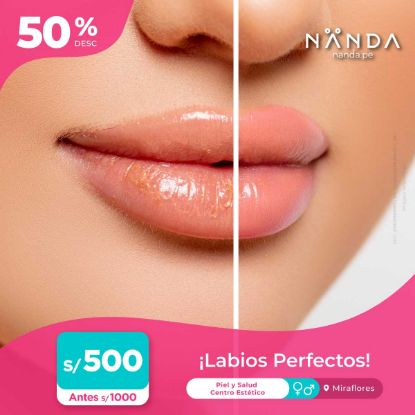 ¡Labios Perfectos! 😍 - Piel y Salud Centro Estético (MIRAFLORES)