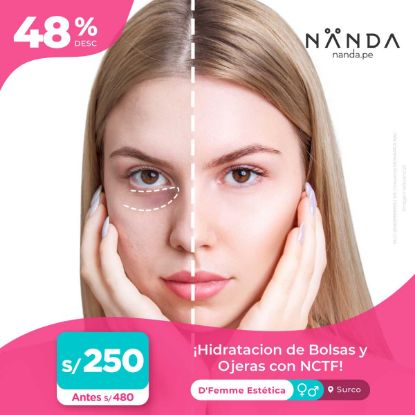 ¡Hidratación de Bolsas y Ojeras con NCTF! 😍 - D'Femme Estética (SURCO)