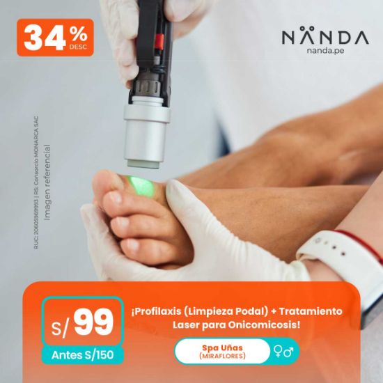 ¡Pofilaxis (Limpieza Podal) + Tratamiento Laser para Onicomicosis! 😍 - Spa Uñas (MIRAFLORES)
